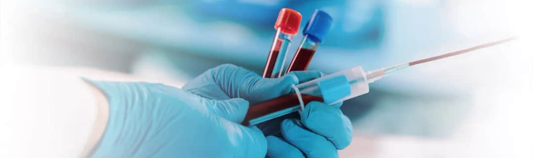 Jakie badania w programie profilaktyki chorób układu krążenia są kluczowe?