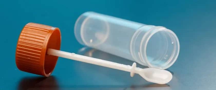 Jak pobierać kał do badania na pasożyty - uniknij najczęstszych błędów