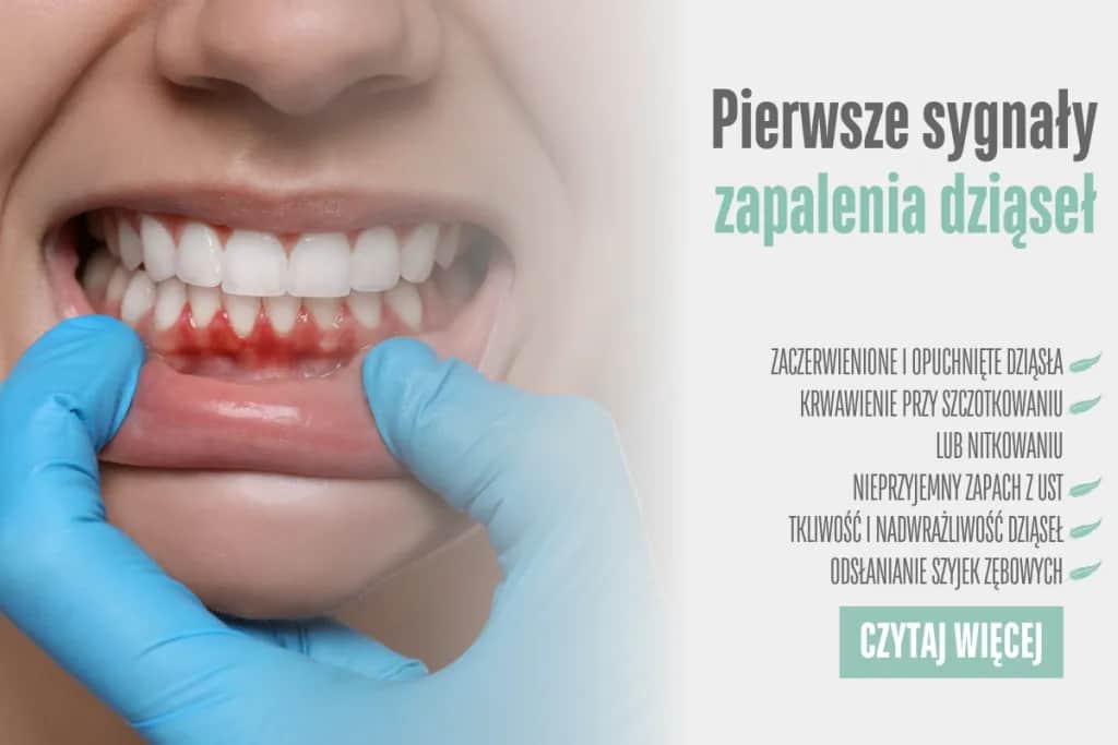 Dlaczego puchną dziąsła? Poznaj przyczyny i skuteczne sposoby leczenia