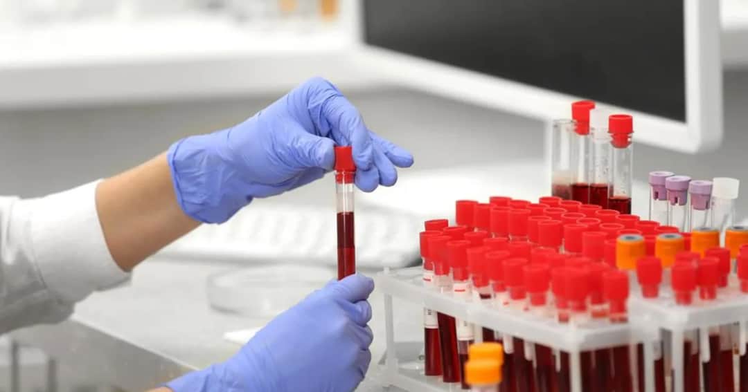 Czy badania krwi ze skierowaniem są płatne? Sprawdź, co musisz wiedzieć