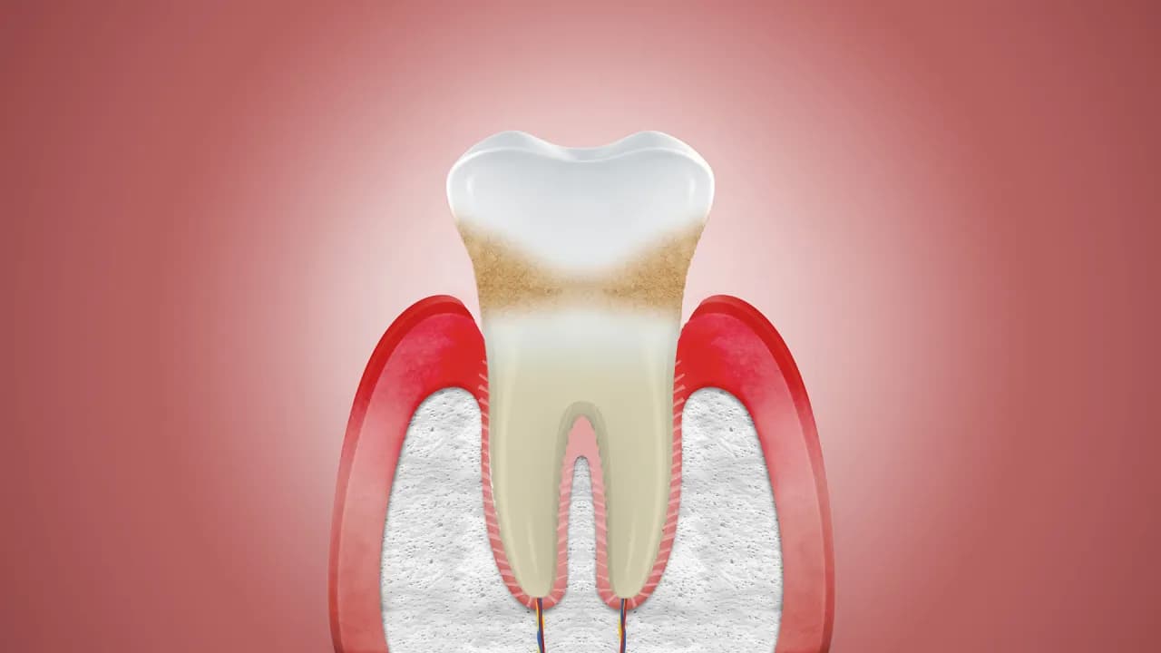 Jak odbudować dziąsła: Skuteczne metody na zdrowe dziąsła bez bólu