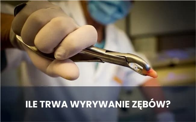 Ile trwa wyrywanie zęba 8? Poznaj czas i co warto wiedzieć przed zabiegiem