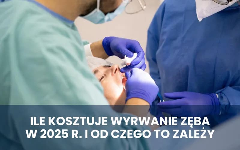 Ile kosztuje wyrwanie zęba 5? Sprawdź ceny i czynniki wpływające na koszt