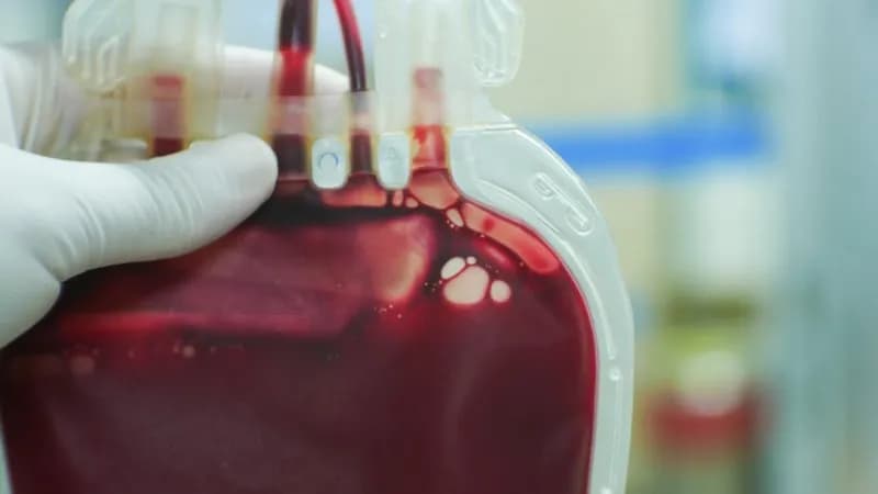 Trombofilią jakie badania: kluczowe testy dla Twojego zdrowia