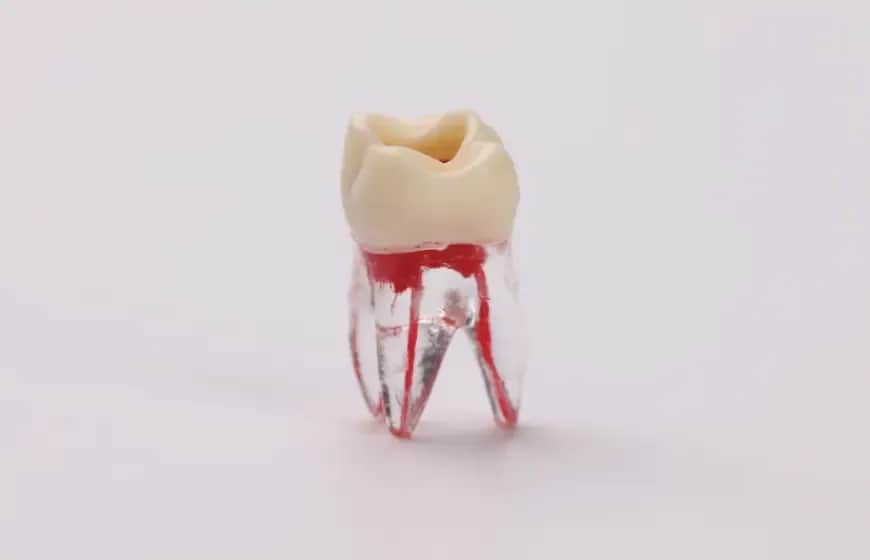 Jak wygląda miazga zęba? Odkryj jej tajemnice i znaczenie dla zdrowia